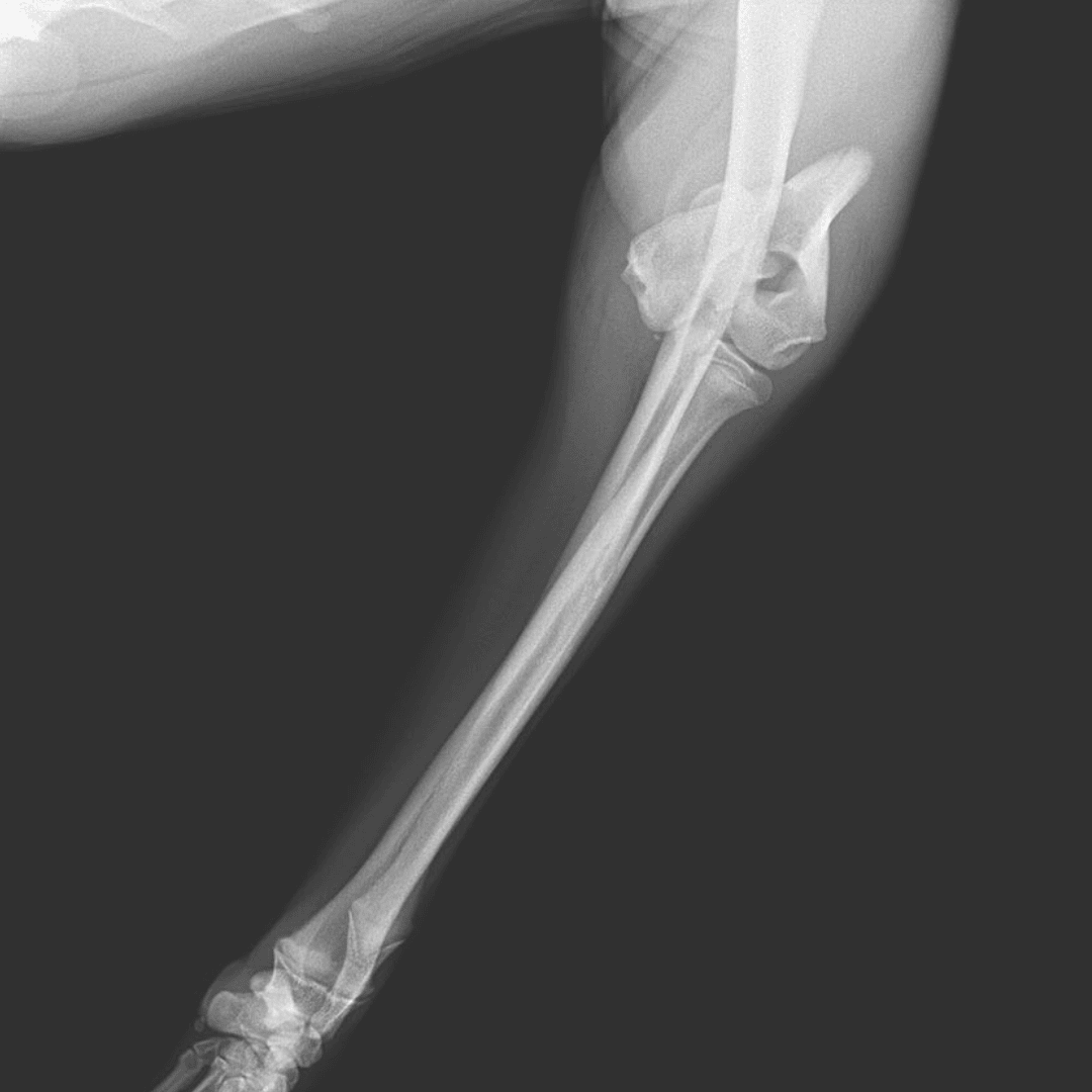 Diagnostyka i leczenie ortopedyczne